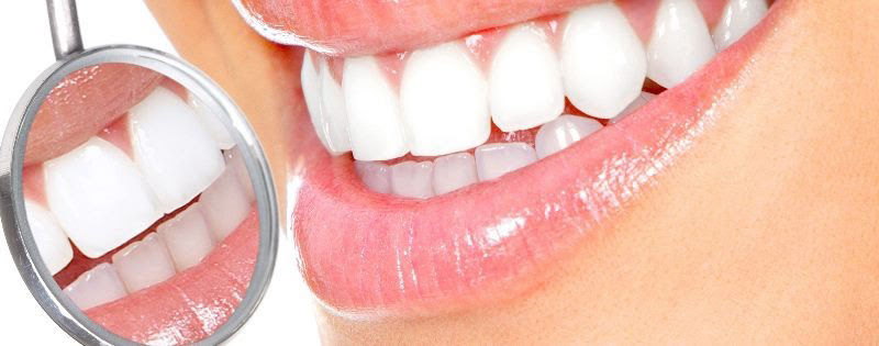 Αισθητική οδοντιατρική -Καθαρισμός δοντιών